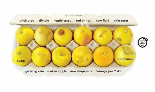 Visual guide showing twelve breast changes to look for, including a hard lump, dimple, nipple crust, new fluid, skin sores, growing vein, sunken nipple, new shape or size and orange-peel skin