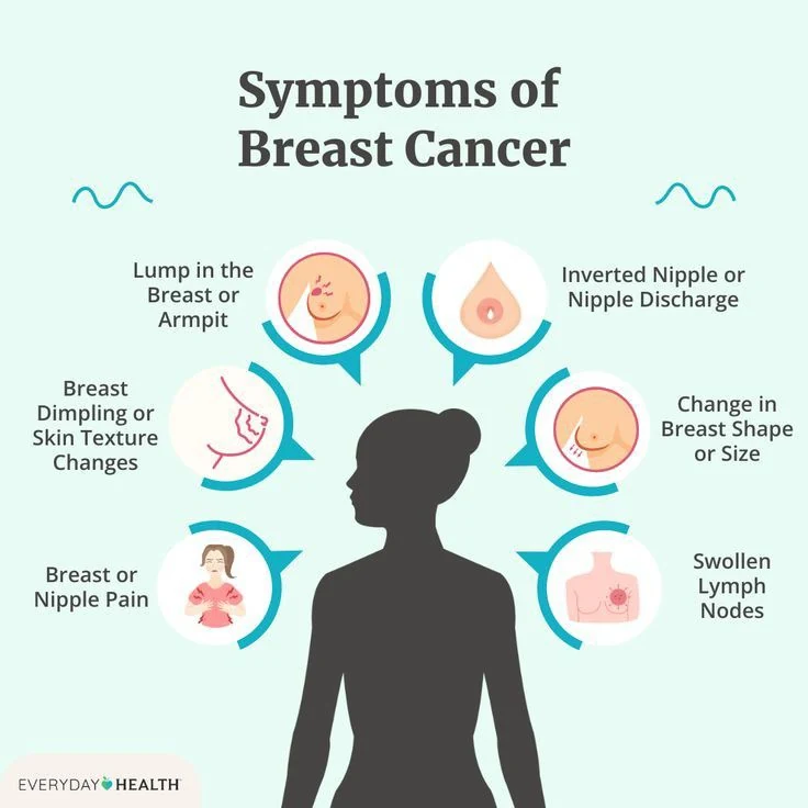 Infographic of common breast cancer symptoms: lump in the breast or armpit, nipple inversion or discharge, skin dimpling, change in breast shape or size, breast or nipple pain and swollen lymph nodes